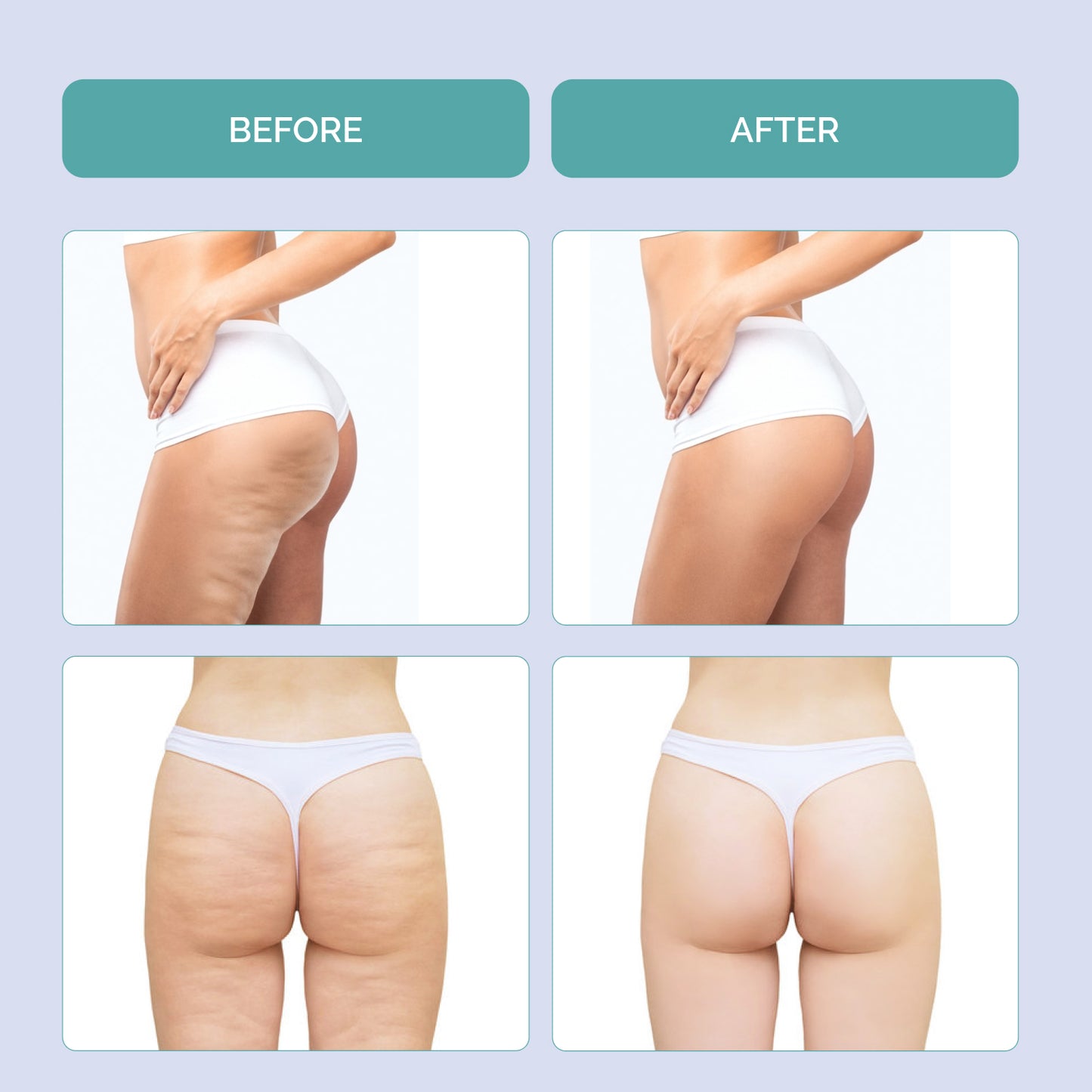 EMS EMIO FatBurn Body Sculpting massaažiseade