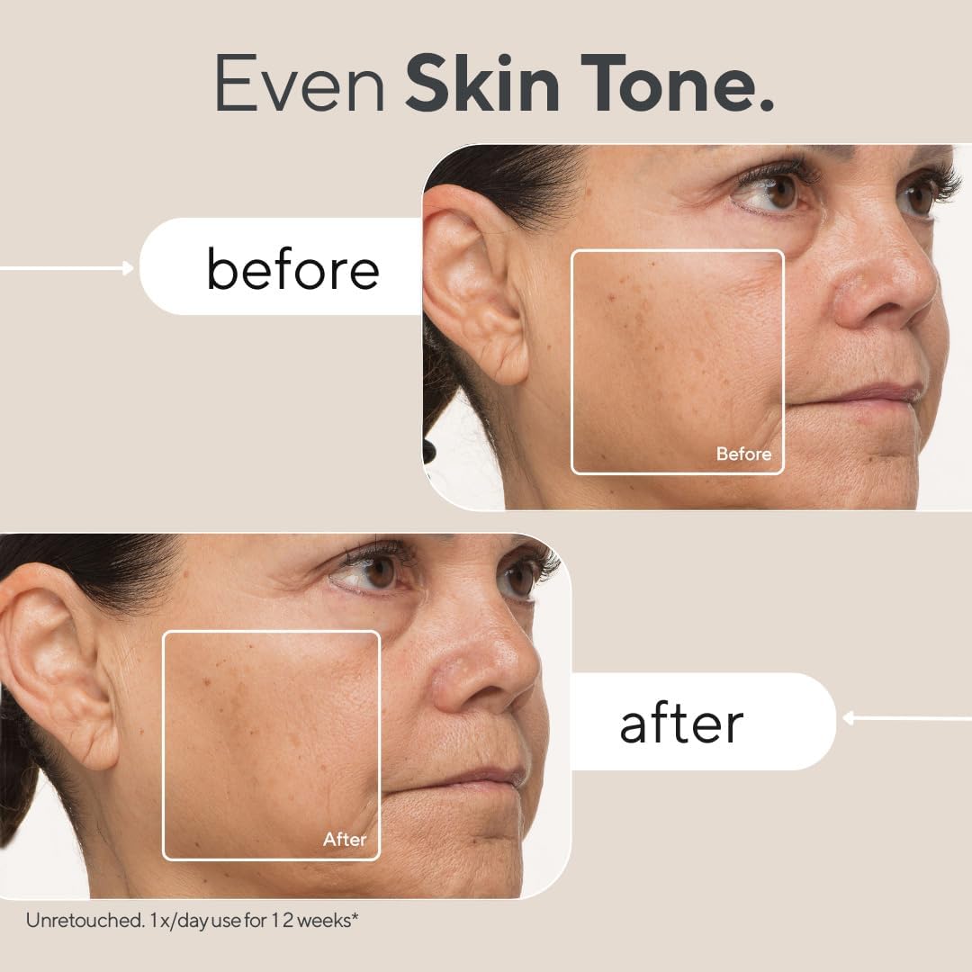 TheraFace Skin Care Mask valguse IR teraapia