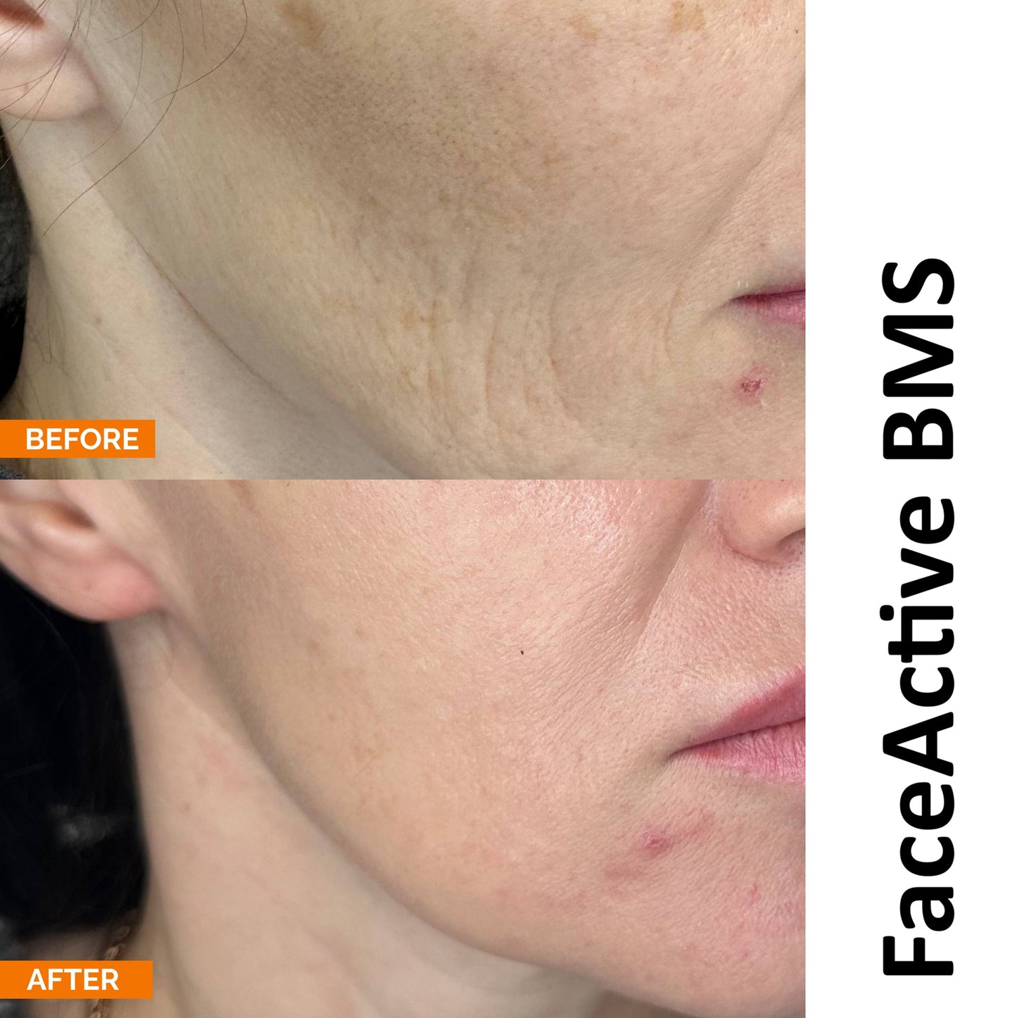 BMS FaceActiveBio iluseade näole